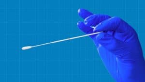 Anal Swab